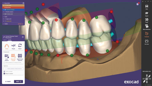 exocad DentalCAD-flex Ultimate Lab Bundle